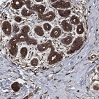 Anti-AKT1S1 Antibody