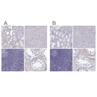 Immunohistochemical staining of human kidney, liver, lymphoid tissues and testis using Anti-MAGEB2 antibody HPA075519 (A) shows similar protein distribution across tissues to independent antibody HPA074544 (B).