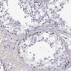 Immunohistochemical staining of human testis shows strong nuclear positivity in spermatogonia.