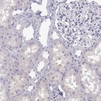 Immunohistochemical staining of human kidney shows no positivity in cells in tubules as expected.
