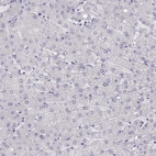 Immunohistochemical staining of human liver shows no positivity in hepatocytes as expected.