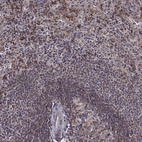 Anti-MTSS1 Antibody