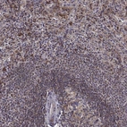 Anti-MTSS1 Antibody