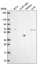 Western blot analysis in human cell line RT-4, human cell line U-251 MG, human plasma and human liver tissue.