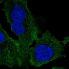 Immunofluorescent staining of human cell line U-2 OS shows localization to plasma membrane & vesicles.