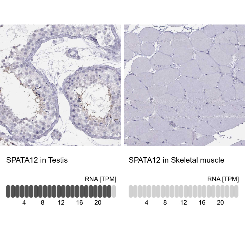 Anti-SPATA12 Antibody