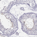Immunohistochemical staining of human testis shows strong cytoplasmic positivity in spermatids.
