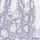 Immunohistochemical staining of human colon shows no positivity in glandular cells as expected.
