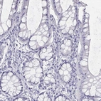 Immunohistochemical staining of human colon shows no positivity in glandular cells as expected.
