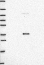 Anti-AMBP Antibody