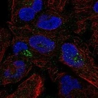 Immunofluorescent staining of human cell line RH-30 shows localization to the Golgi apparatus & vesicles.