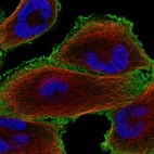 Anti-CRYBG3 Antibody