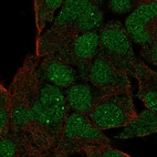 Anti-GSC Antibody