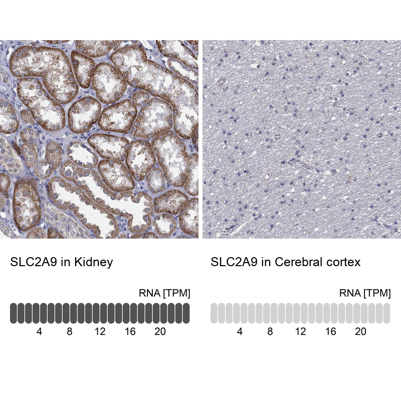 Anti-SLC2A9 Antibody