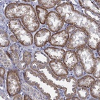 Immunohistochemical staining of human kidney shows high expression.