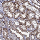 Immunohistochemical staining of human kidney shows high expression.