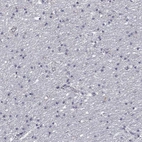 Immunohistochemical staining of human cerebral cortex shows low expression as expected.