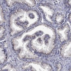 Anti-FRG1 Antibody
