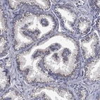 Anti-FRG1 Antibody