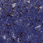 Anti-KIF22 Antibody