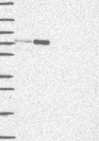 Lane 1: Marker [kDa] 250, 130, 95, 72, 55, 36, 28, 17, 10 | Lane 2: RT4 | Lane 3: U-251 MG | Lane 4: Human Plasma | Lane 5: Liver | Lane 6: Tonsil