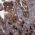 Anti-MSRA Antibody