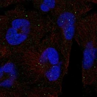 Anti-CLTCL1 Antibody