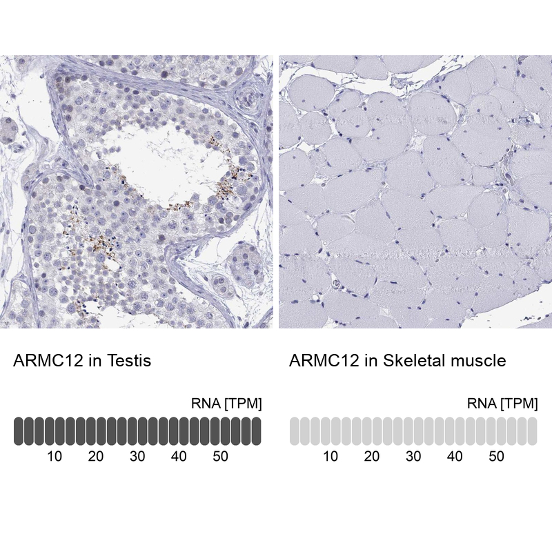 Anti-ARMC12 Antibody