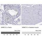 Anti-ARMC12 Antibody