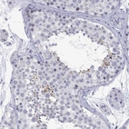 Immunohistochemical staining of human testis shows high expression.