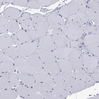 Immunohistochemical staining of human skeletal muscle shows low expression as expected.
