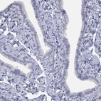 Immunohistochemical staining of human fallopian tube shows low expression as expected.