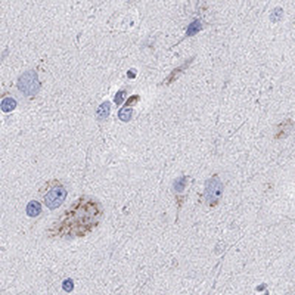 Anti-LRRC4C Antibody
