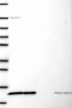Lane 1: Marker [kDa] 250, 130, 95, 72, 55, 36, 28, 17, 10 | Lane 2: RT4 | Lane 3: U-251 MG | Lane 4: Human Plasma | Lane 5: Liver | Lane 6: Tonsil