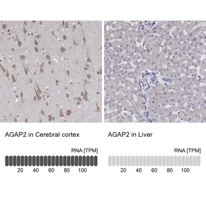 Anti-AGAP2 Antibody