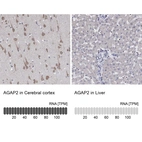Anti-AGAP2 Antibody