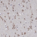 Immunohistochemical staining of human cerebral cortex shows high expression.