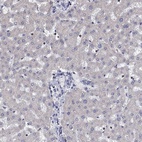 Anti-AGAP2 Antibody