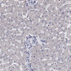 Immunohistochemical staining of human liver shows low expression as expected.
