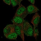 Immunofluorescent staining of human cell line SH-SY5Y shows localization to nucleoplasm & cytosol.