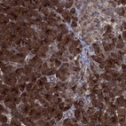 Anti-TMEM33 Antibody