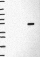 Lane 1: Marker [kDa] 250, 130, 95, 72, 55, 36, 28, 17, 10 | Lane 2: RT4 | Lane 3: U-251 MG | Lane 4: Human Plasma | Lane 5: Liver | Lane 6: Tonsil