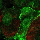 Immunofluorescent staining of human cell line EFO-21 shows localization to nucleoplasm, nuclear membrane & plasma membrane.