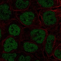 Anti-TBX3 Antibody