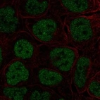 Anti-TBX3 Antibody