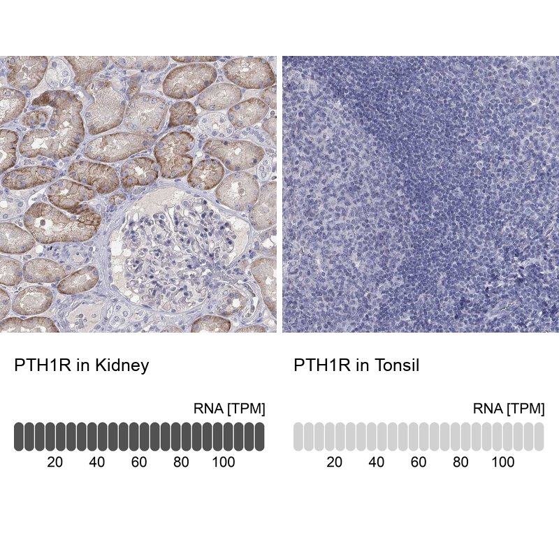 Anti-PTH1R Antibody