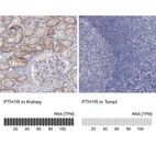 Anti-PTH1R Antibody