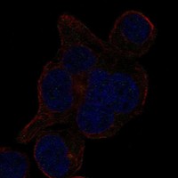 Anti-LRRCC1 Antibody