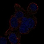 Anti-LRRCC1 Antibody