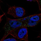 Anti-NLRC4 Antibody
